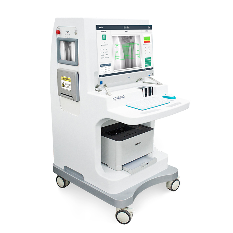 X-ray BDM KDX8000